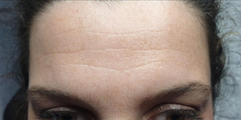 עמית לוסקי 2 עמית לוסקי 2